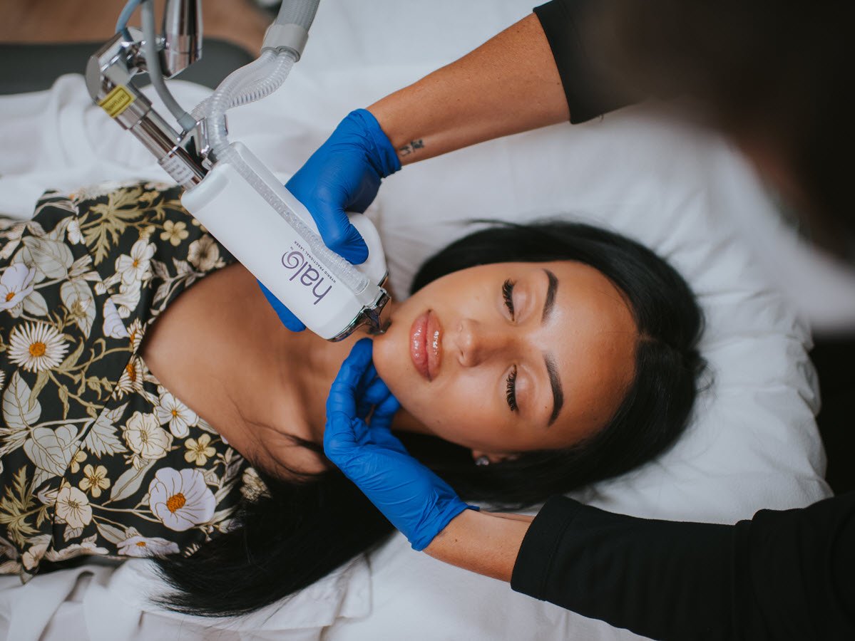 You are currently viewing What Areas Can Be Treated With Halo Treatment