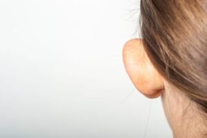 Read more about the article What Recovery Time Is Needed After Otoplasty