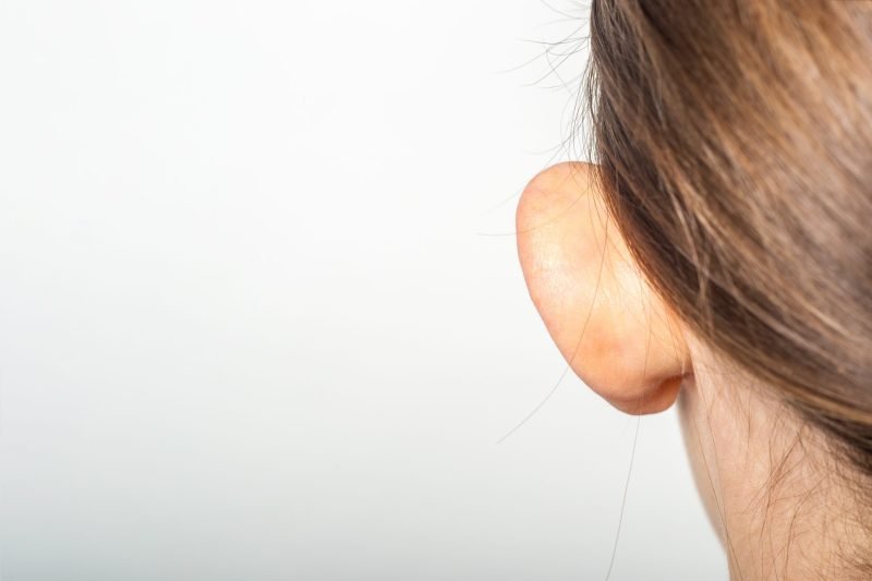 You are currently viewing What Recovery Time Is Needed After Otoplasty