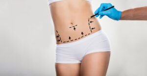 Read more about the article What to Expect from Waist Sculpting Sessions