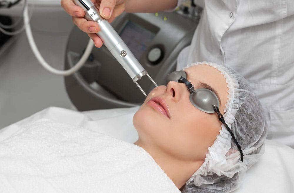 Fractional CO2 Laser