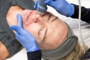 Read more about the article How Does Fractional RF Microneedling Give Supple, Luminous Texture?