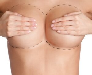 Read more about the article Breast Augmentation Surgery: Before You Make the Decision