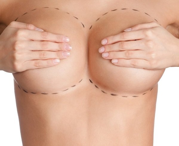 You are currently viewing Breast Augmentation Surgery: Before You Make the Decision