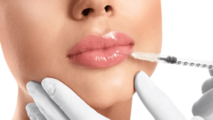 Read more about the article Advanced Lip Contouring with Russian Lip Fillers