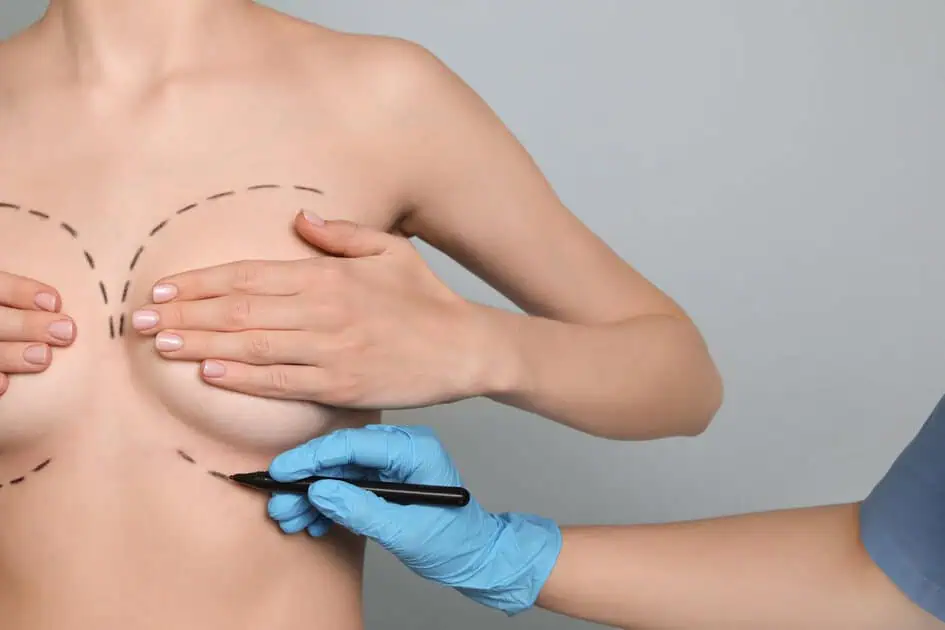 You are currently viewing How Can Breast Augmentation Achieve Balanced and Alluring Curves?