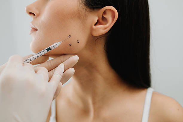 You are currently viewing Can Jawline Fillers Enhance Side Profile?