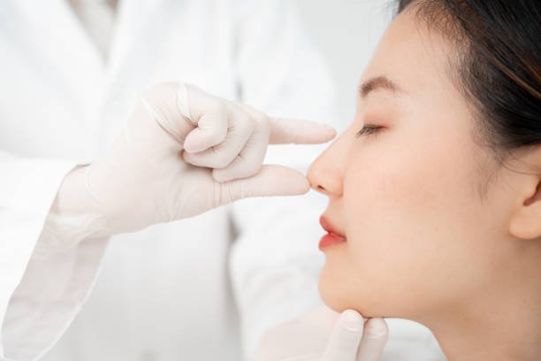 You are currently viewing Can Rhinoplasty Reduce a Dorsal Hump?
