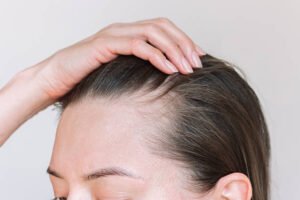 Read more about the article Can Vitamin-Based Therapies Treat Hair Loss & Nail Disorders?