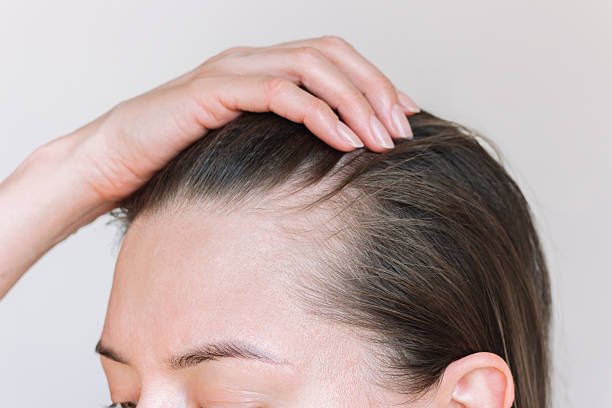 You are currently viewing Can Vitamin-Based Therapies Treat Hair Loss & Nail Disorders?