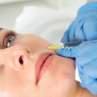 You are currently viewing Natural-Looking Cheek Volume with Fillers