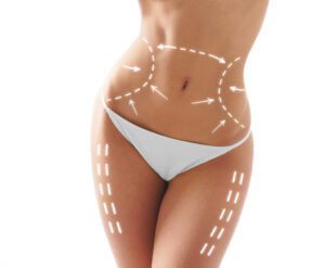 Read more about the article Customised Waist Sculpting Treatments