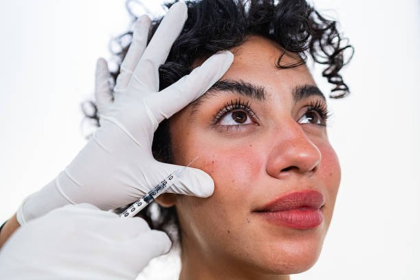 You are currently viewing Do Under Eye Fillers Reduce Dark Circles?