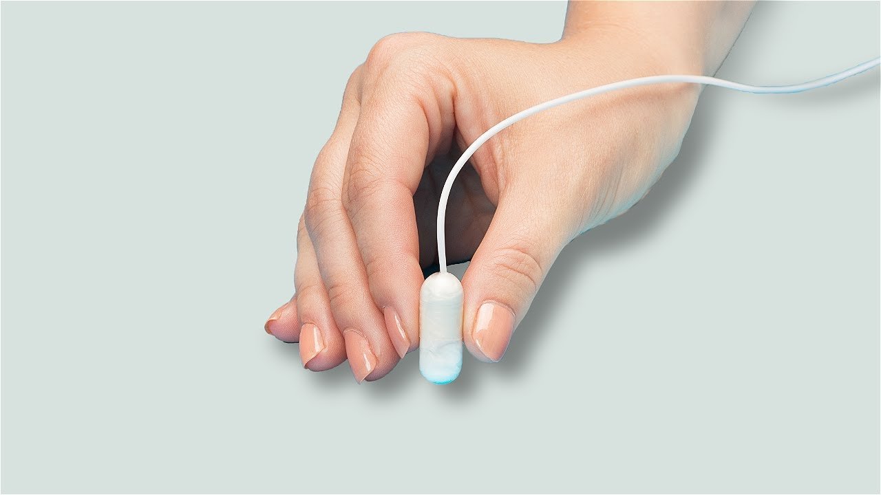 You are currently viewing Does Allurion Gastric Balloon Need Endoscopy