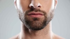 Read more about the article Does Beard Transplant Look Natural After Healing