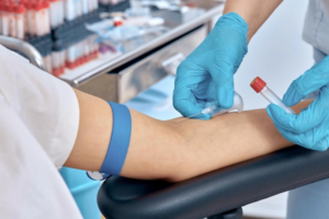 Read more about the article Does Blood Test Require Fasting Before Test