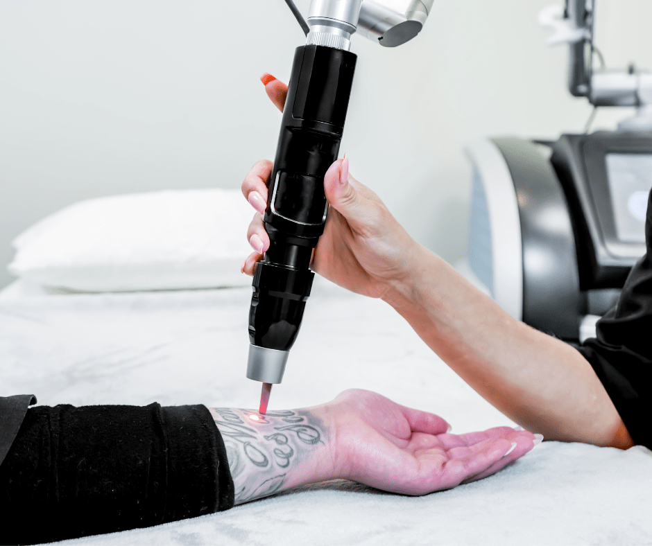 Read more about the article Does Picosure Tattoo Removal Require Special Aftercare