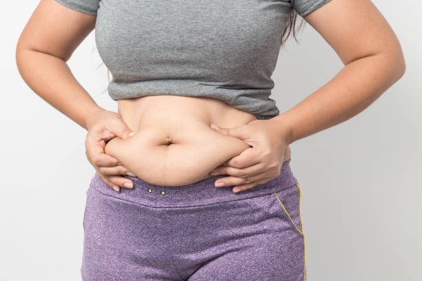 You are currently viewing Does Tummy Tuck Address Stubborn Belly Fat?