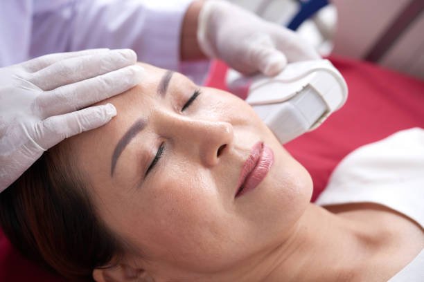 You are currently viewing HIFU Treatment  for Age-Defying Results