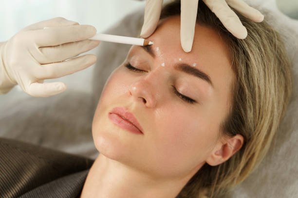 You are currently viewing How Botox Injection Helps Reduce Wrinkles Fast