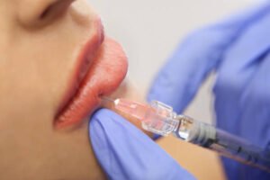 Read more about the article How Do Russian Lip Fillers Enhance Shape?