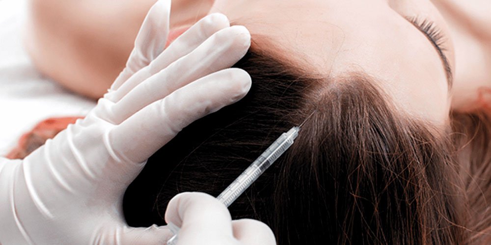 You are currently viewing How Effective Is Exosomes Hair Treatment?