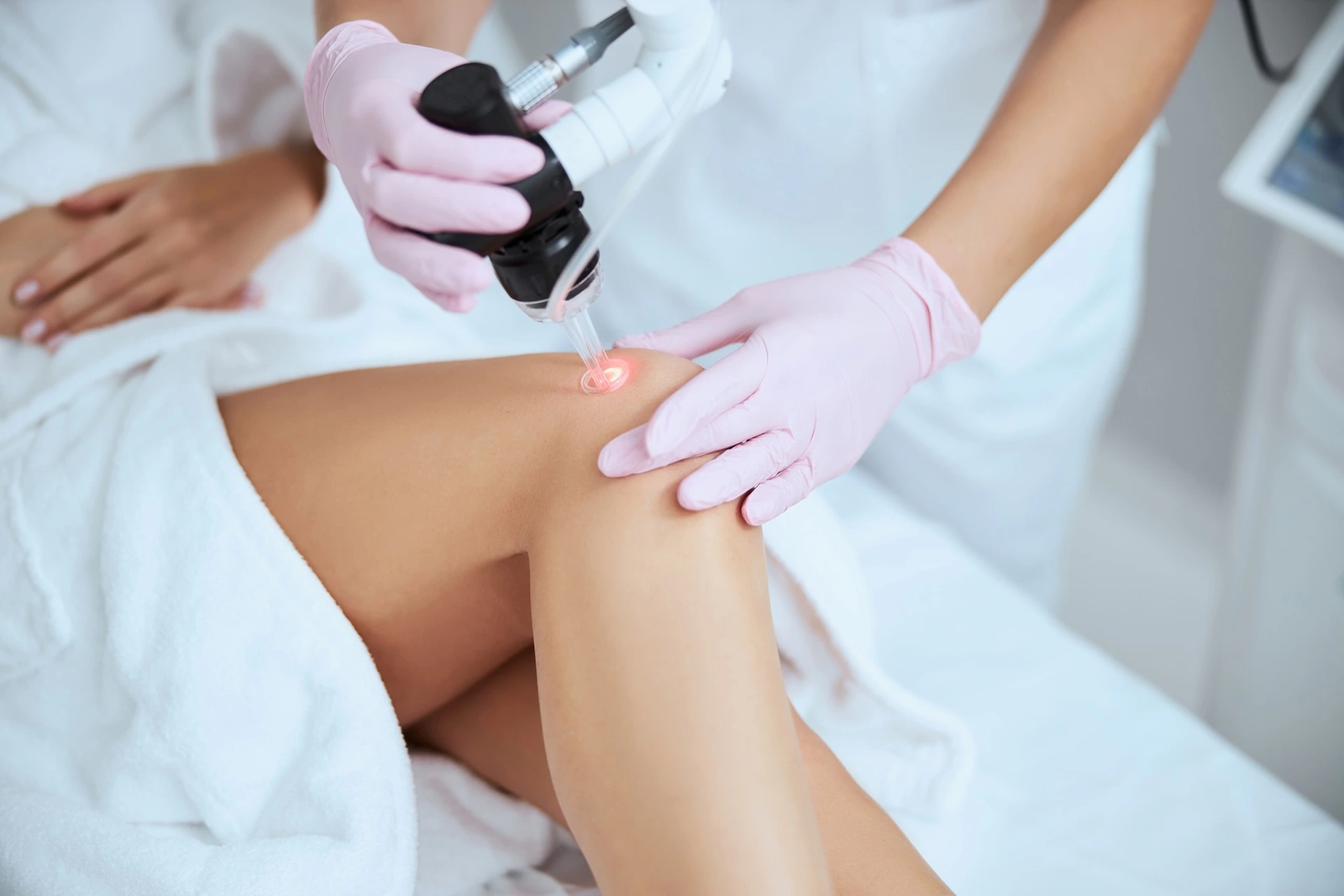 You are currently viewing How Long Do Results Last After Sclerotherapy Treatment