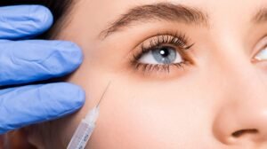 Read more about the article Revive Dull Eyes Using Under Eye Fillers
