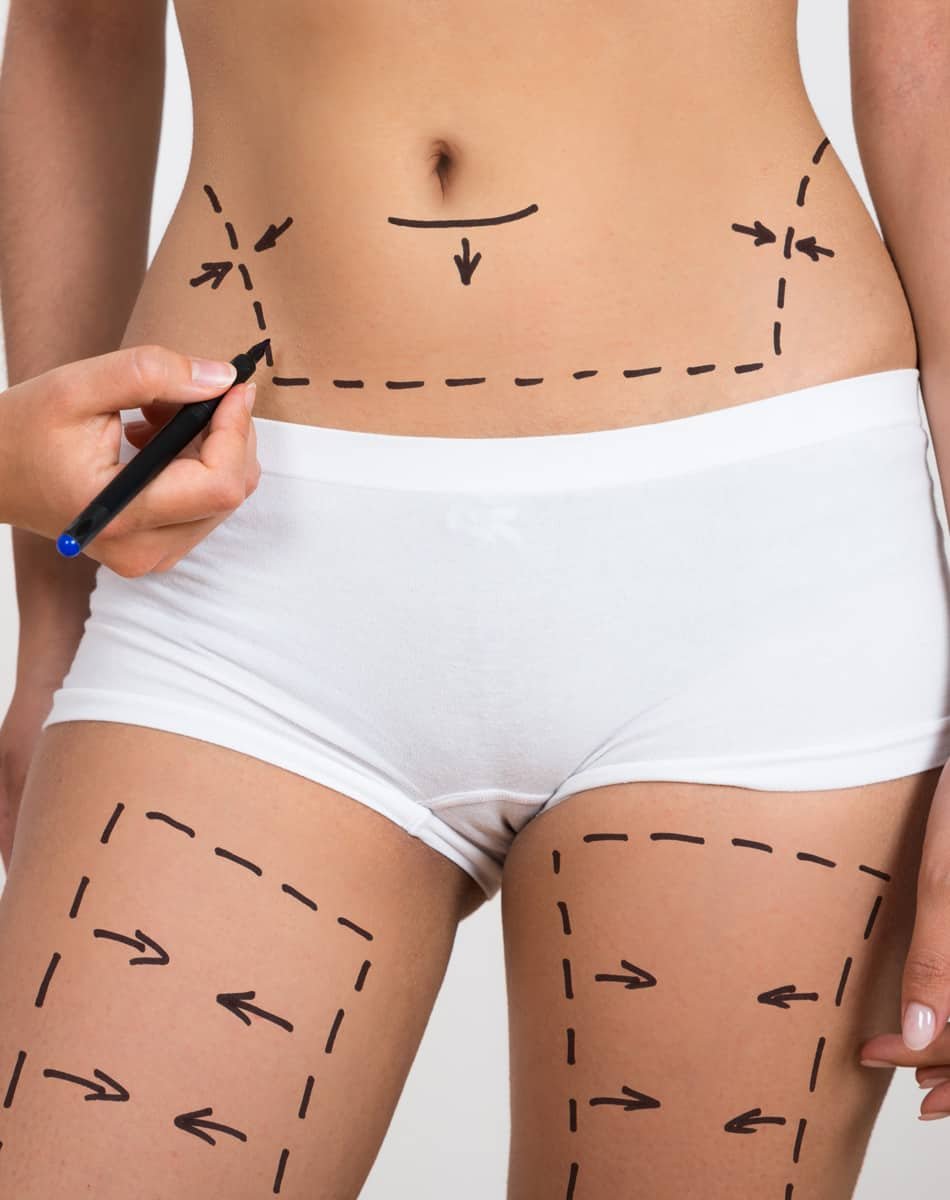 You are currently viewing SculpSure for Fast and Comfortable Sessions