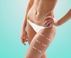 Read more about the article Unlock Your Best Body with Vaser 4D Liposuction