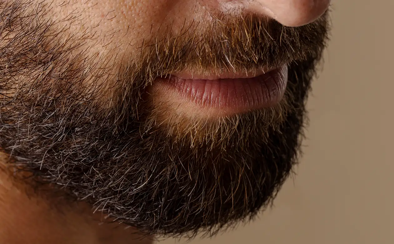 You are currently viewing What Age Is Best for Beard Transplant Surgery