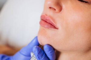 Read more about the article What Are the Benefits of Dermal Fillers Injections?
