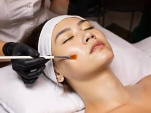 Read more about the article What Happens During a Professional Chemical Peel