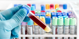 Read more about the article What Should You Know Before a Blood Test Appointment