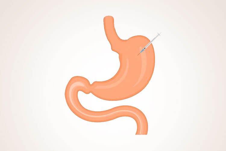 You are currently viewing ما مدى سرعة مفعول حقن البوتوكس؟