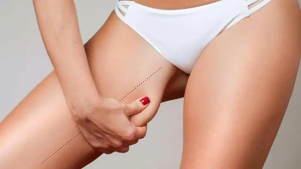 You are currently viewing متى تظهر نتائج عملية شد الفخذين؟