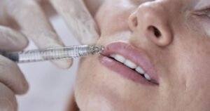 Read more about the article Achieve Balanced Lips with Lip Fillers Injection
