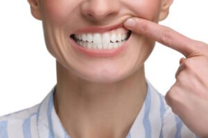 Read more about the article Can Gum Grafting Help in Gum Recession Treatment ?