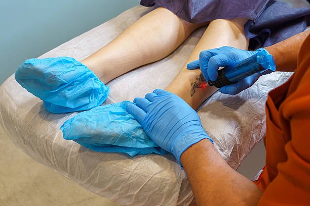 You are currently viewing Can Laser Tattoo Removal Remove Recent Tattoos?