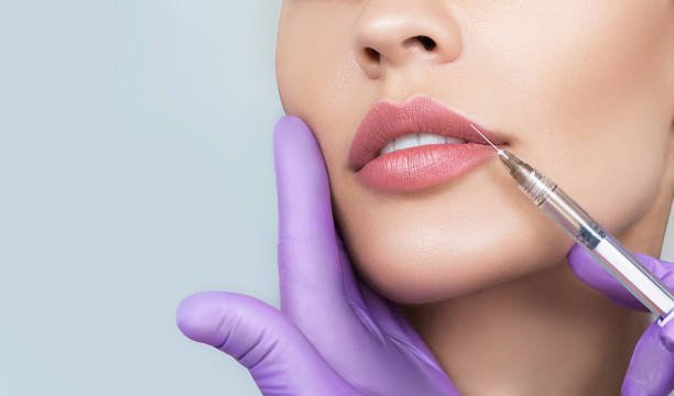 You are currently viewing Can Lip Fillers Improve Lip Symmetry?