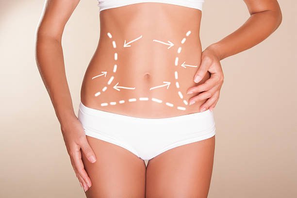You are currently viewing Can Liposuction Improve Body Shape Quickly?