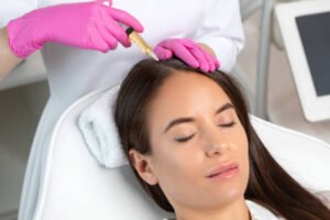Read more about the article Can PRP Hair Treatment Improve Scalp Health?