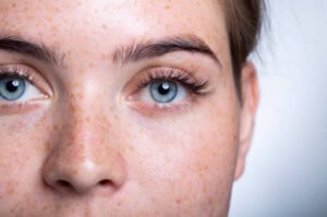 Read more about the article Does Eye Bag Removal Reduce Puffiness Fast?