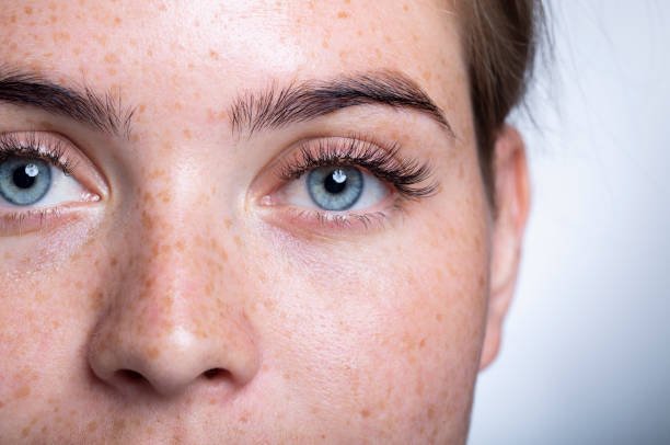 You are currently viewing Does Eye Bag Removal Reduce Puffiness Fast?