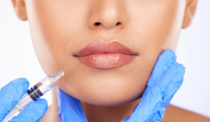 Read more about the article Elevate Your Confidence with Lip Augmentation