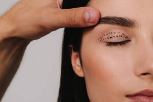 Read more about the article Eyelid Surgery in 7 Things to Know Before You Start