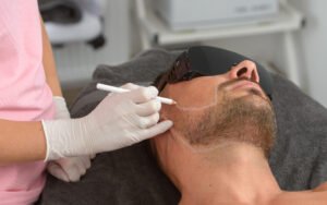Read more about the article How Effective Is Men’s Laser Hair Removal?