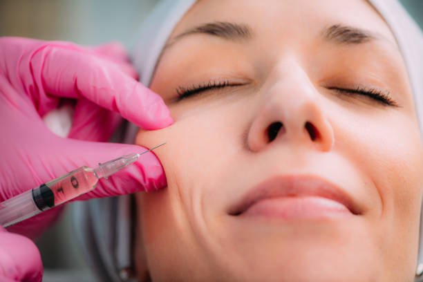 You are currently viewing How Long Do Cheek Fillers Injections Actually Last?