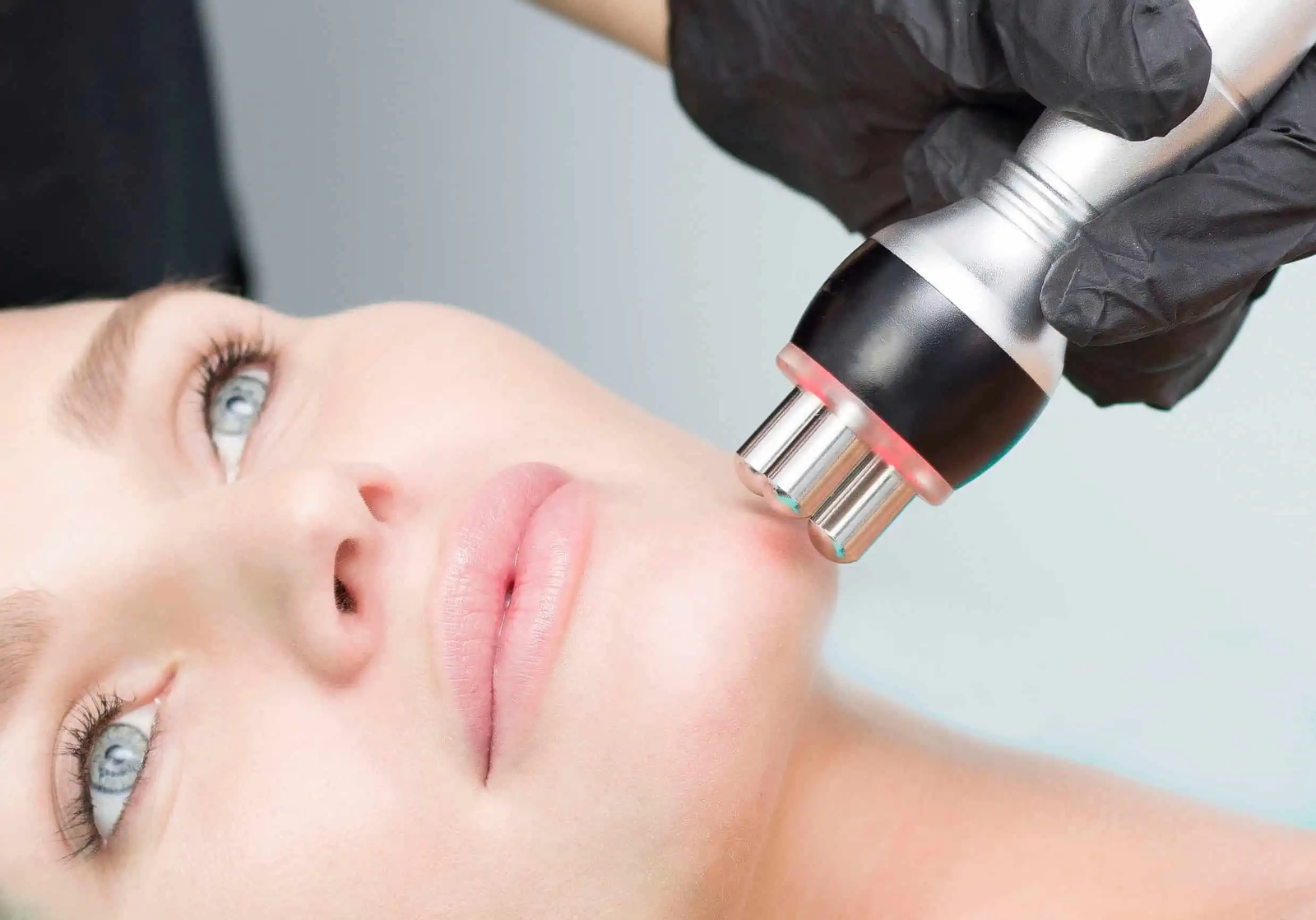 You are currently viewing How Long Do Radiofrequency Treatments Last?