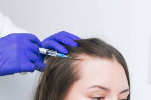Read more about the article Is PRP Hair Treatment Worth Trying?